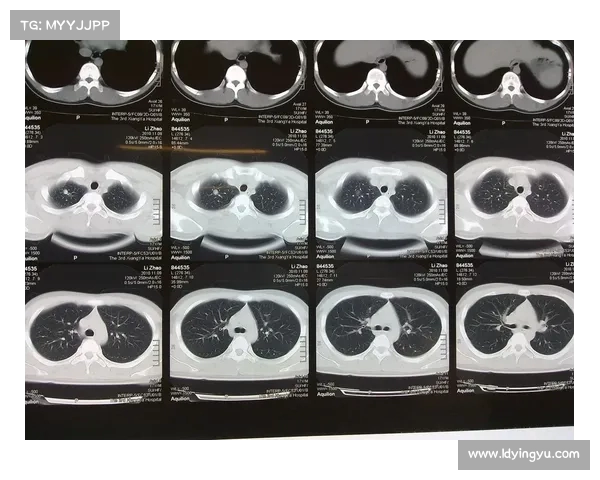震惊医疗界:患者因m肺结节行穿刺术后死亡,医院被认定负次责(肺结节穿刺后有啥风险) 震惊医疗界:患者因m肺结节行穿刺术后死亡,医院被认定负次责(肺结节穿刺后有啥风险)